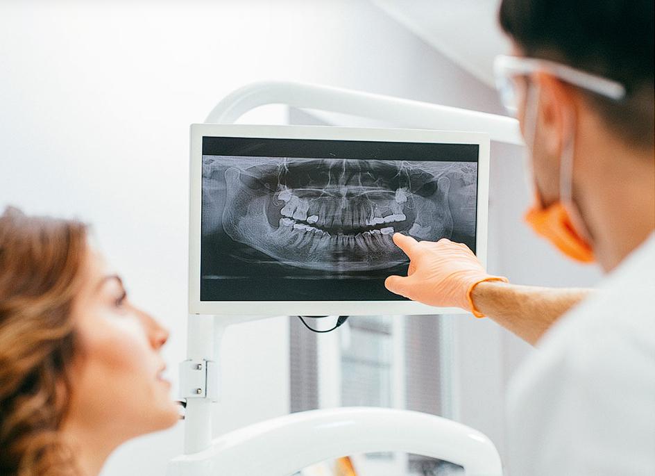 Radiografie dentară – Megadent